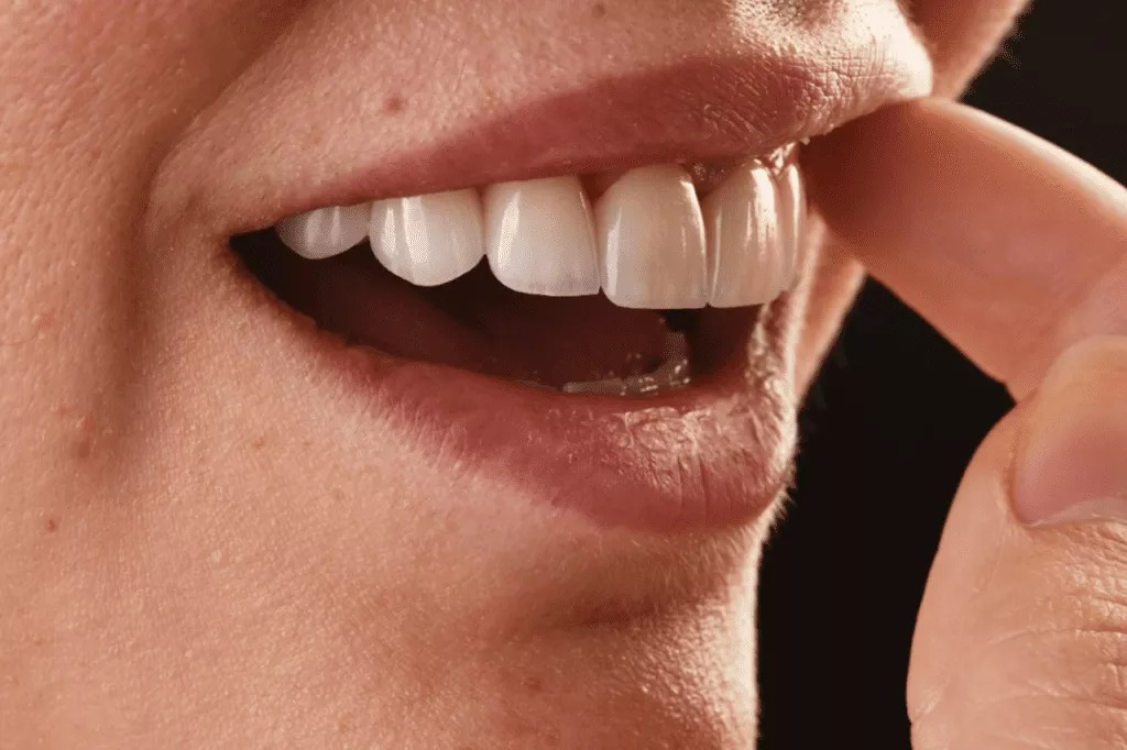 How to Achieve the Perfect Smile? Tips for a Radiant Smile